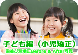 小児矯正の写真